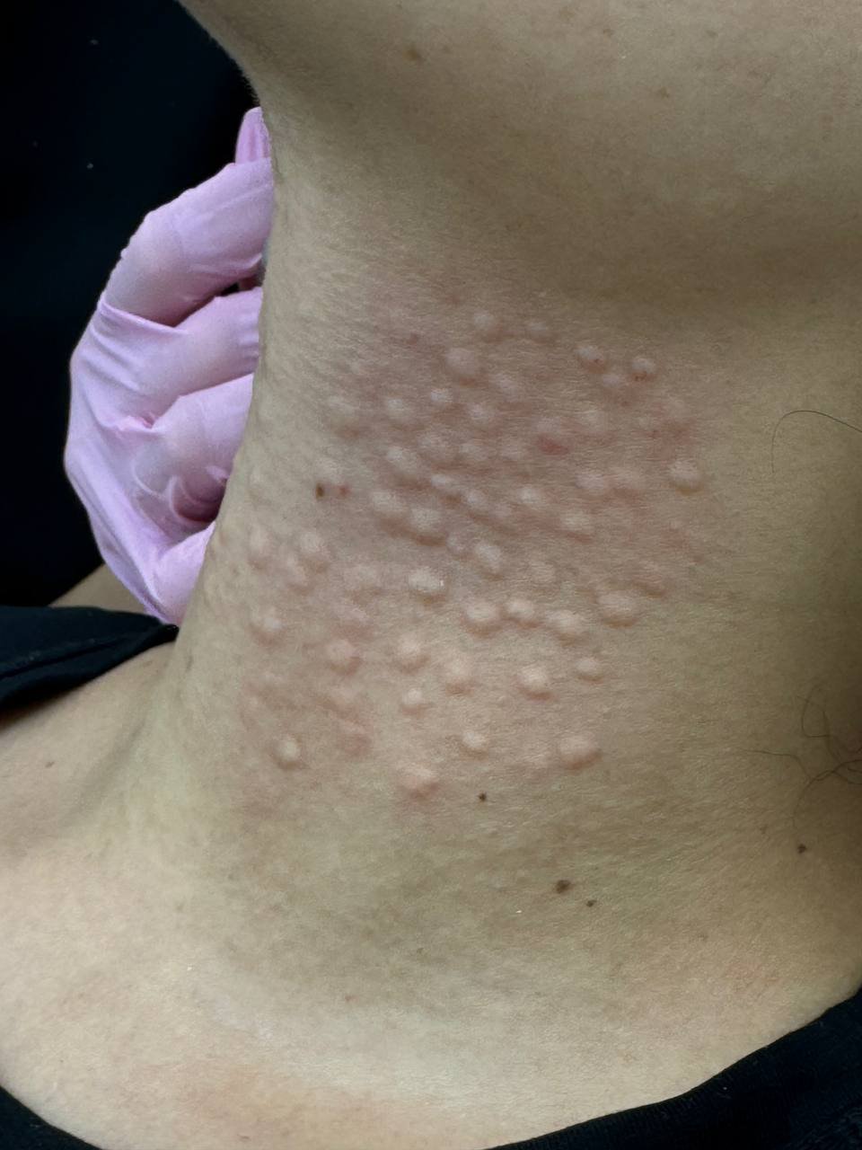 Коллагеновый комплекс Коллост - Лебединая шея