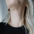 Отзыв о Клиника эстетической медицины и косметологии FaceLifting: faceliftingmsk отвратительный результат обман