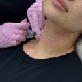 Отзыв о Коллагеновый комплекс Коллост: Лебединая шея