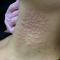 Отзыв о Коллагеновый комплекс Коллост: Лебединая шея